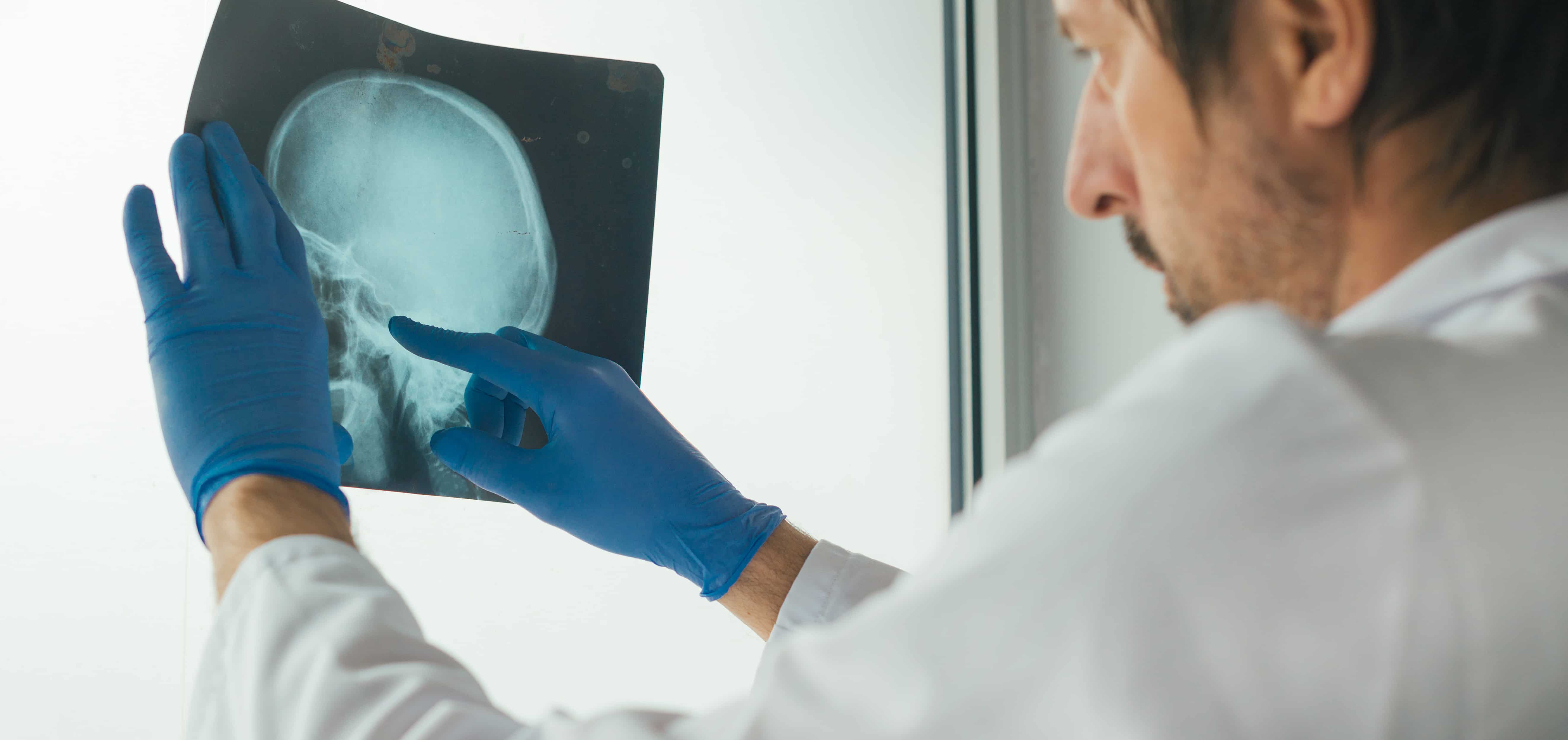 Dental X-ray